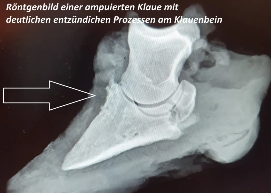 Röntgenbild einer amputierten Kuhklaue, auf dem deutlich entzündliche Prozesse am Knochen des Vorderbeins sichtbar sind – tiermedizinische Diagnostik.